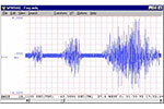 Electromyogram (EMG) Waveform Analysis Software with Advanced CODAS