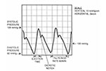 A Closer Look at the Advanced CODAS Peak Capture Algorithm