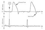 A Closer Look at Waveform Integration with Advanced CODAS